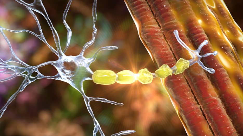 Illustration of neuron with myelin sheath breaking down